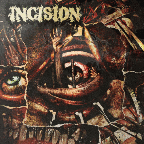 Incision (CAN) : Incision